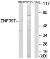 Western blot of extracts from HeLa/HUVEC cells, using ZNF397 Antibody. The lane on the right is treated with the synthesized peptide.