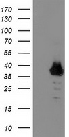 HEK293T cells were transfected with the pCMV6-ENTRY control (Left lane) or pCMV6-ENTRY ZNF397 (Right lane) cDNA for 48 hrs and lysed. Equivalent amounts of cell lysates (5 ug per lane) were separated by SDS-PAGE and immunoblotted with anti-ZNF397.
