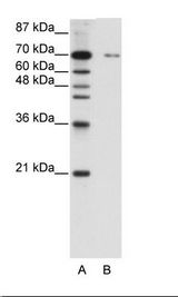 A: Marker, B: HepG2 Cell Lysate