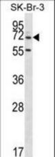 ZNF398 Antibody western blot of SK-BR-3 cell line lysates (35 ug/lane). The ZNF398 antibody detected the ZNF398 protein (arrow).