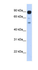 ZNF408 antibody LS-C110414 Western blot of Transfected 293T cell lysate.