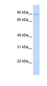 ZNF408 antibody LS-C109814 Western blot of Transfected 293T cell lysate.