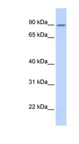 ZNF408 antibody LS-C101453 Western blot of Transfected 293T cell lysate.