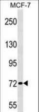 ZNF408 Antibody western blot of MCF-7 cell line lysates (35 ug/lane). The ZNF408 antibody detected the ZNF408 protein (arrow).