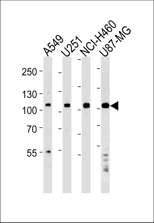 Western blot of lysates from A549,U251,NCI-H460,U87-MG cell line (from left to right),using ZNF41 Antibody. Antibody was diluted at 1:1000 at each lane. A goat anti-rabbit IgG H&L (HRP) at 1:5000 dilution was used as the secondary antibody.Lysates at 35ug per lane.