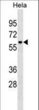 ZNF410 Antibody western blot of HeLa cell line lysates (35 ug/lane). The ZNF410 antibody detected the ZNF410 protein (arrow).