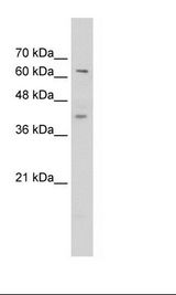 Jurkat Cell Lysate