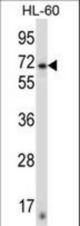 ZNF415 Antibody western blot of HL-60 cell line lysates (35 ug/lane). The ZNF415 antibody detected the ZNF415 protein (arrow).