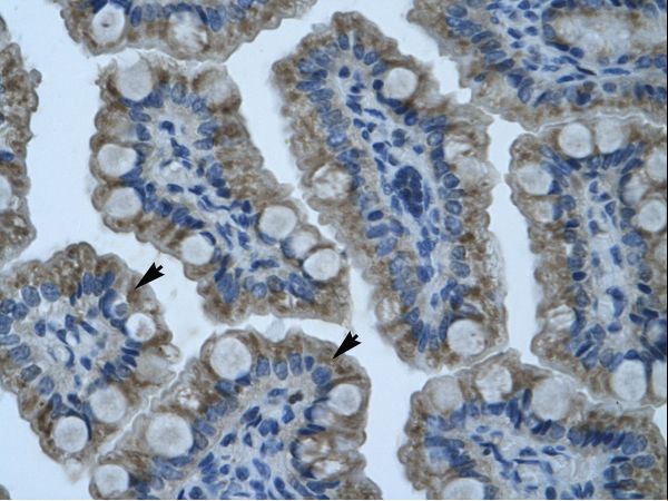 ZNF461 antibody LS-C31632 was used in IHC to stain formalin-fixed, paraffin-embedded human intestine.