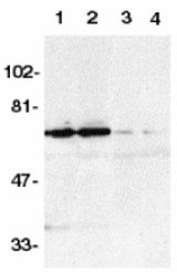 Western blot of DR6 in K562 (1,3) and Raji (2,4) whole cell lysate in the absence (1,2) or presence (3,4) of blocking peptide (Catalog no. 2157P) with DR6 antibody at 1:500 dilution.