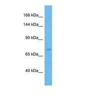 Western blot of Human Thyroid Tumor. ZNF471 antibody dilution 1.0 ug/ml.