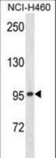 Western blot of ZN473 Antibody in NCI-H460 cell line lysates (35 ug/lane). ZN473 (arrow) was detected using the purified antibody.