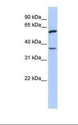 721_B cell lysate. Antibody concentration: 1.0 ug/ml. Gel concentration: 12%.
