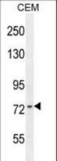ZNF493 Antibody western blot of CEM cell line lysates (35 ug/lane). The ZNF493 antibody detected the ZNF493 protein (arrow).