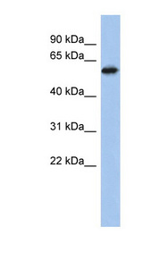 ZNF496 antibody LS-C109551 Western blot of PANC1 cell lysate.