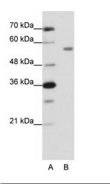 A: Marker, B: HepG2 Cell Lysate
