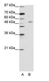 A: Marker, B: Jurkat Cell Lysate
