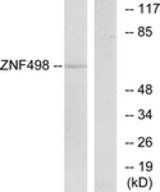 Western blot of extracts from COS7 cells, using ZNF498 Antibody. The lane on the right is treated with the synthesized peptide.