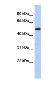 ZNF498 antibody LS-C110447 Western blot of Jurkat lysate.