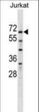 ZNF498 Antibody western blot of Jurkat cell line lysates (35 ug/lane). The ZNF498 antibody detected the ZNF498 protein (arrow).