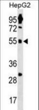 ZNF500 Antibody western blot of HepG2 cell line lysates (35 ug/lane). The ZNF500 antibody detected the ZNF500 protein (arrow).
