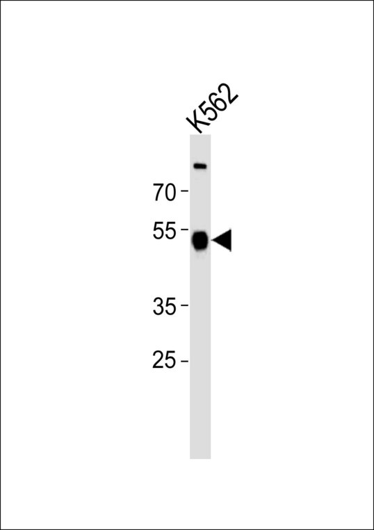 Western blot of lysate from K562 cell line, using ZNF500 Antibody. Antibody was diluted at 1:1000. A goat anti-rabbit IgG H&L (HRP) at 1:10000 dilution was used as the secondary antibody. Lysate at 20ug.