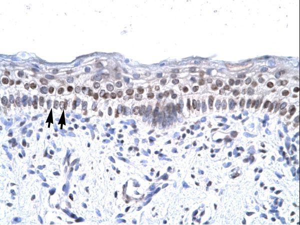 ZNF500 antibody LS-C29673 was used in IHC to stain formalin-fixed, paraffin-embedded human spermatophore.