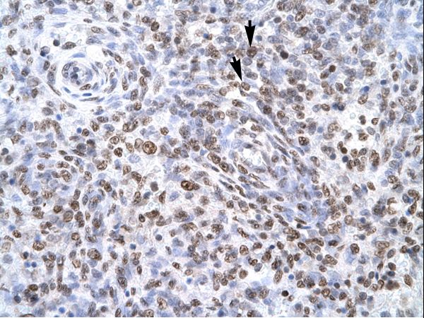 ZNF500 antibody LS-C29673 was used in IHC to stain formalin-fixed, paraffin-embedded human spleen.