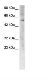 Jurkat Cell Lysate