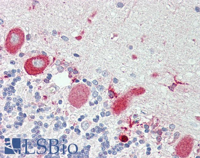 Anti-TNFRSF21 / DR6 antibody IHC staining of human brain, cerebellum. Immunohistochemistry of formalin-fixed, paraffin-embedded tissue after heat-induced antigen retrieval. Antibody LS-B10688 dilution 1:75.
