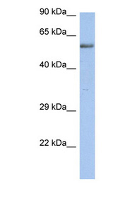 ZNF513 antibody LS-C109600 Western blot of Fetal Kidney lysate.