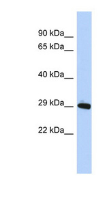 ZNF524 antibody LS-C101811 Western blot of MCF7 cell lysate.