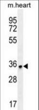 ZNF524 Antibody western blot of mouse heart tissue lysates (35 ug/lane). The ZNF524 antibody detected the ZNF524 protein (arrow).