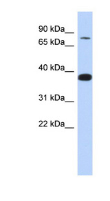 ZNF526 antibody LS-C101374 Western blot of MCF7 cell lysate.