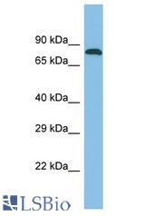 ZNF526 antibody Western Blot of Fetal Kidney. Antibody dilution: 1 ug/ml.