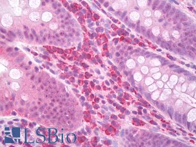 Anti-DR3 antibody IHC of human colon, plasma cells. Immunohistochemistry of formalin-fixed, paraffin-embedded tissue after heat-induced antigen retrieval. Antibody LS-B7731 dilution 5 ug/ml.