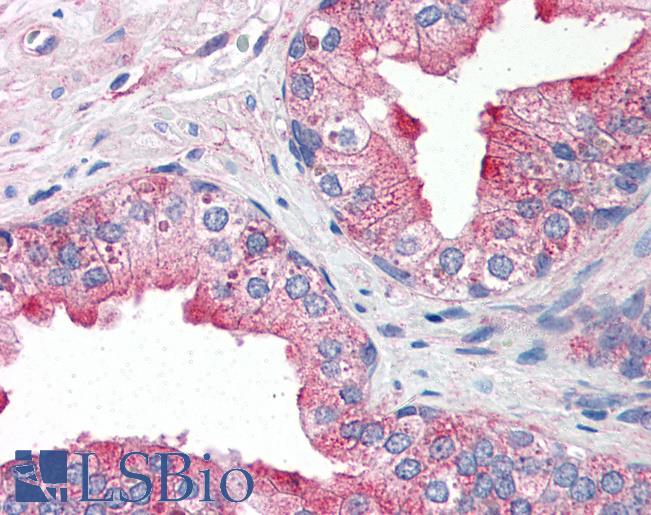 Anti-DR3 antibody IHC of human prostate. Immunohistochemistry of formalin-fixed, paraffin-embedded tissue after heat-induced antigen retrieval. Antibody LS-B2705 concentration 10 ug/ml.