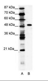 A: Marker, B: Jurkat Cell Lysate