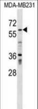 ZNF543 Antibody western blot of MDA-MB231 cell line lysates (35 ug/lane). The ZNF543 antibody detected the ZNF543 protein (arrow).