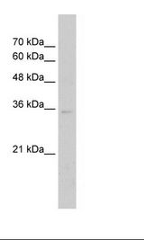 Jurkat Cell Lysate