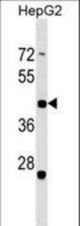 ZNF547 Antibody western blot of HepG2 cell line lysates (35 ug/lane). The ZNF547 antibody detected the ZNF547 protein (arrow).