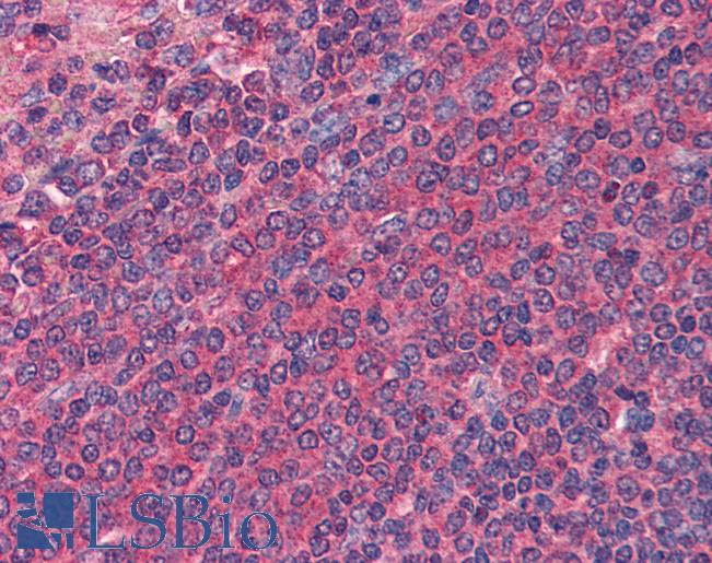 Anti-DR3 antibody IHC of human spleen. Immunohistochemistry of formalin-fixed, paraffin-embedded tissue after heat-induced antigen retrieval. Antibody LS-B2704 concentration 3 ug/ml.