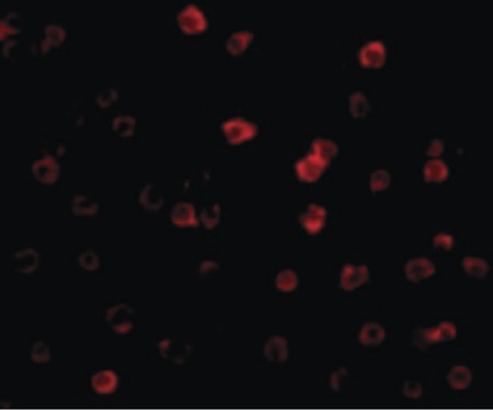 Immunofluorescence of DR3 in Jurkat cells with DR3 antibody at 20 ug/ml.