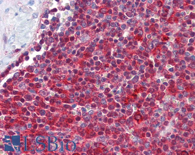 Human Spleen: Formalin-Fixed, Paraffin-Embedded (FFPE)