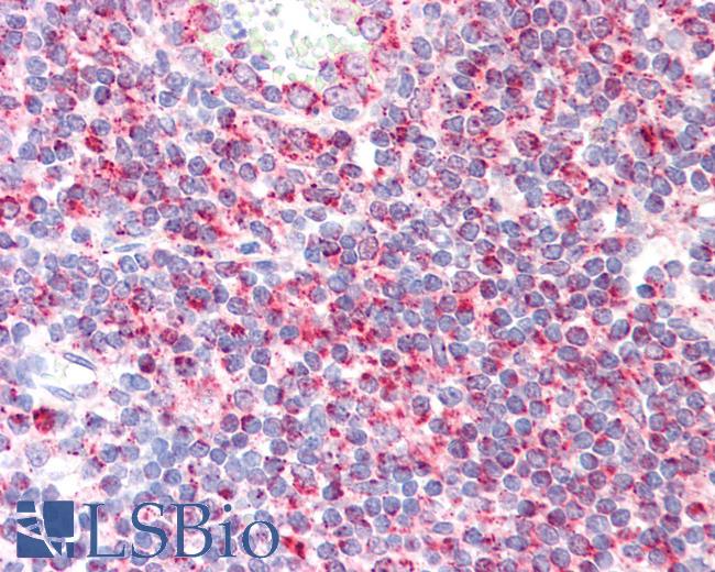 Human Tonsil: Formalin-Fixed, Paraffin-Embedded (FFPE)
