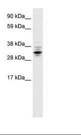 Fetal Lung Lysate