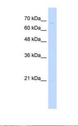 721_B cell lysate. Antibody concentration: 1.0 ug/ml. Gel concentration: 12%.