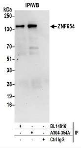 Detection of Human ZNF654 by Western Blot of Immunoprecipitates. Samples: Whole cell lysate (0.5 or 1.0 mg per IP reaction; 20% of IP loaded) from 293T cells. Antibodies: Affinity purified rabbit anti-ZNF654 antibody used for IP at 6 ug per reaction. ZNF654 was also immunoprecipitated by rabbit anti-ZNF654 antibody BL14816. For blotting immunoprecipitated ZNF654, was used at 1 ug/ml. Detection: Chemiluminescence with an exposure time of 30 seconds.