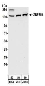 Detection of Human ZNF654 by Western Blot. Samples: Whole cell lysate (50 ug) from HeLa, 293T, and Jurkat cells. Antibodies: Affinity purified rabbit anti-ZNF654 antibody used for WB at 0.1 ug/ml. Detection: Chemiluminescence with an exposure time of 30 seconds.
