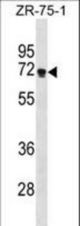 ZNF654 Antibody western blot of ZR-75-1 cell line lysates (35 ug/lane). The ZNF654 antibody detected the ZNF654 protein (arrow).